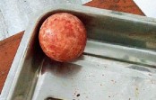জরায়ু কাটতেই বেরোল বল