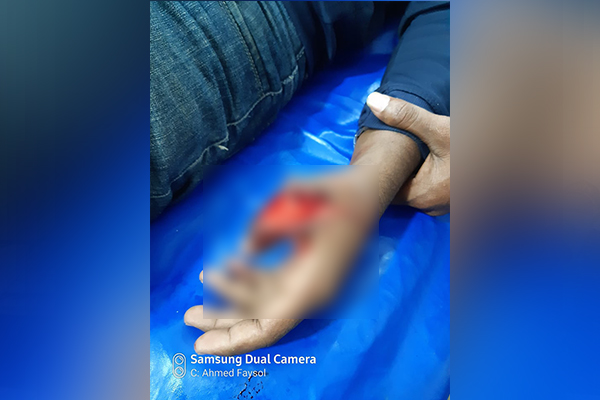 নাসিরনগরে স্বেচ্ছাসেবী সংগঠনের সদস্যরা ডাকাতির কবলে, আহত ১
