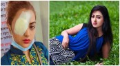 লেন্স গলে চোখ হারানোর পথে চিত্রনায়িকা
