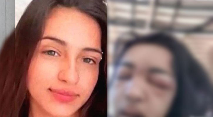 ফ্যাশনের জন্য ভ্রু ছিদ্র, ধুকে ধুকে মারা গেল স্কুলছাত্রী